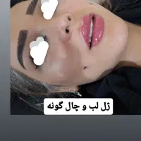 نخ فیلر|خدمات آرایشگری و زیبایی|تبریز, |دیوار