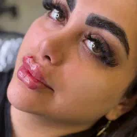 کیلینیک تخصصی ژل و‌بوتاکس مزو فیلر بادی باسن