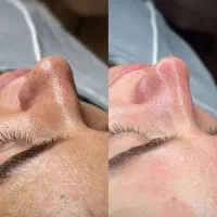 5مدل فیشیال و پاکسازی برای تکمیل البوم کاری