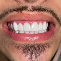 جشنواره کامپوزیت هر فک فقط4/500|خدمات آرایشگری و زیبایی|کرج, استاندارد|دیوار