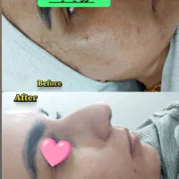 فقط هزینه مواد|خدمات آرایشگری و زیبایی|آزادشهر, |دیوار