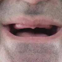 دندانسازی (ساخت دندان مصنوعی تعمیر دندان مصنوعی )|خدمات آرایشگری و زیبایی|تهران, مشیریه|دیوار