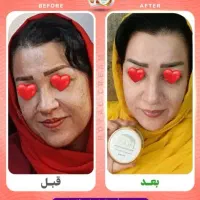 کرم ژل رویال صد در صد تضمینی|آرایشی، بهداشتی، درمانی|شیراز, حافظیه|دیوار