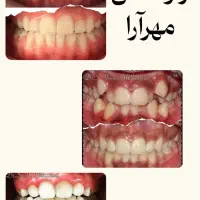 ارتودنسی کن ۶ الی ۱۸ماهه پرداخت کن