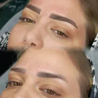 مدل برای فیبروز