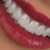 زیبای|خدمات آرایشگری و زیبایی|تهران, سلسبیل شمالی|دیوار