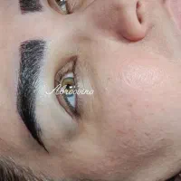 کاشت ابرو سر و ریش تخصصی تضمینی