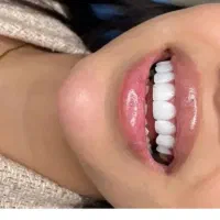 دندانپزشکی با بیمه