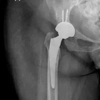رادیولوژی و سونوگرافی در منزل تهران و کرج