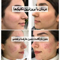 اموزش فیشال|خدمات آموزشی|مشهد, دانشجو|دیوار