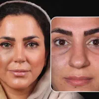 تخفیف 50%|خدمات زیبایی و سلامت|کرمانشاه, |دیوار
