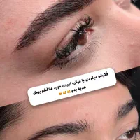 میکرو کرکی مویی با تخفیف ویژه