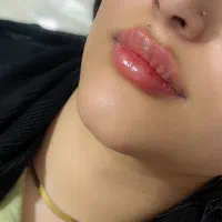 آف فیلر و بوتاکس فقطط۵۸۰