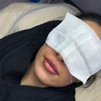 تزریق ژل و بوتاکس اف تا فردافقط۹۸۰|خدمات آرایشگری و زیبایی|یاسوج, |دیوار