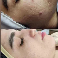 اولین اتاق پوست صومعه سرا با تراپی های درمانی|خدمات آرایشگری و زیبایی|صومعه‌سرا, |دیوار