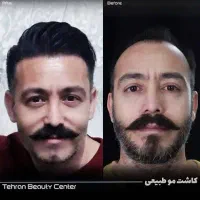 تور خدمات و جراحی زیبایی|خدمات آرایشگری و زیبایی|گرگان, |دیوار