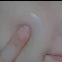 فرمول کرم روشن کننده ضدلک و ضدجوش تضمینی