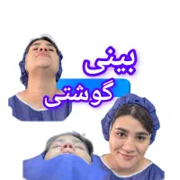 جراحی بینی دربیمارستان|خدمات آرایشگری و زیبایی|تهران, میدان ولیعصر|دیوار
