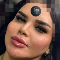 تزریق تخصصی ژل ومادلینگ خلیجی واروپایی وبوتاکس|خدمات آرایشگری و زیبایی|کرمانشاه, |دیوار