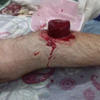 حجامت وبادکش گرم آقا وخانم|خدمات آرایشگری و زیبایی|بندرعباس, |دیوار