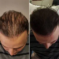 همیشه حق با موهاته