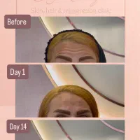 جشنواره تخفیفات بهاری خدمات پوست و زیبایی