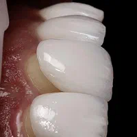 خدمات دندانسازی و دندانپزشکی با تعرفه ویژه|خدمات آرایشگری و زیبایی|شیراز, هفت تنان|دیوار