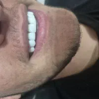 kampozit|خدمات آرایشگری و زیبایی|فولادشهر, C5|دیوار