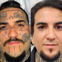 پاک کردن تاتو ابرو و بدن در کرمان