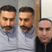 کاشت مو تخصصی|خدمات آرایشگری و زیبایی|تبریز, |دیوار