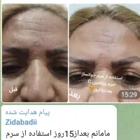 سرم جوانساز سلولهای بنیادی گل رز|آرایشی، بهداشتی، درمانی|شاهین‌شهر, امام حسین|دیوار