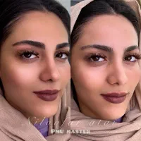 آموزش میکروبلیدینگ.فیبروز نچرال بروز کرکی‌مویی