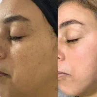 کرم های بیومیمتیک