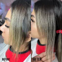 موخوره تراپی تخصصی و کات خطی