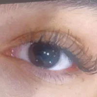 کاشت مژه
