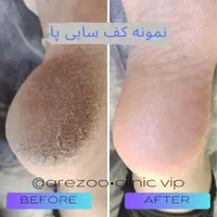 همکاری با مترجم**عربی زبان**در حوزه زیبایی پزشکی|استخدام بازاریابی و فروش|اصفهان, مرداویج|دیوار