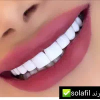 کامپوزیت دندان، روکش، دندانپزشکی تخصصی تهرانسر|خدمات آرایشگری و زیبایی|تهران, تهرانسر مرکزی|دیوار