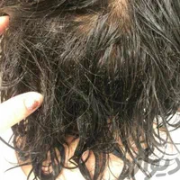 محلول شپش و رشک در چهل دقیقه حظوری و غیر حظوری
