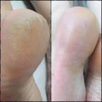 خدمات پدیکور پا بانوان