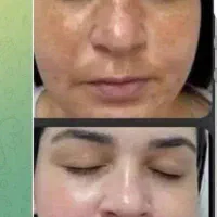 استقلال مالی ودرمان باطب سنتی آنلاین ویژه بانوان|استخدام بازاریابی و فروش|کرج, اکبرآباد|دیوار