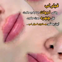 جشنواره زیبایی کلینیک آس|خدمات آرایشگری و زیبایی|تهران, تهرانسر مرکزی|دیوار