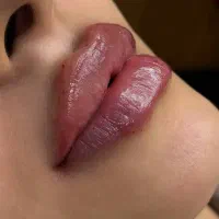 بمب تخفیف خدمات زیبایی ژل بوتاکس جوانساز بادی|خدمات آرایشگری و زیبایی|اهر, |دیوار