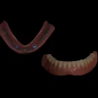 دندان سازی یک روزه یزدی با ضمانت