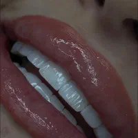 دندانپزشکی اقساطی بدون بهره