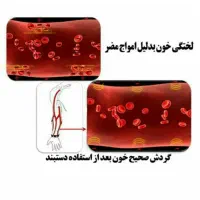 دستبند مغناطیسی درمانی rainso اصل|بدلیجات|تهران, جردن|دیوار