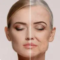 لیفت صورت با اقساط ۶ تا ۱۲ ماه