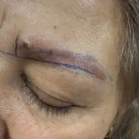 دیگه نگران تاتوهای قدیمی نباش کاور تاتو قدیمی|خدمات آرایشگری و زیبایی|گرمسار, |دیوار