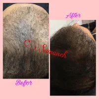 بوتاکس،ژل،چربی،ساکشن غبغب،آموزش سابسیژن پی ارپی|خدمات آرایشگری و زیبایی|اصفهان, شاهزید|دیوار