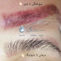 ریموو تتو یک جلسه|خدمات آرایشگری و زیبایی|اصفهان, فرح آباد|دیوار