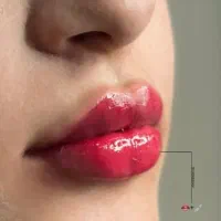 بوتاکس و ژل و سایر خدمات زیبایی و جراحی در مطب